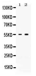 Anti-Activin Receptor Type IIB/ACVR2B Antibody Picoband® Boster Bio