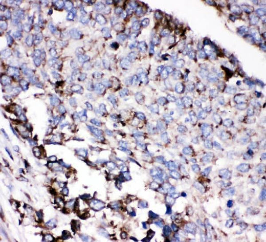 Anti-AEBP2 Antibody Picoband® Boster Bio