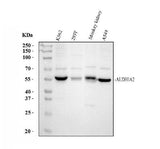 Anti-ALDH1A2 Antibody Picoband® Boster Bio
