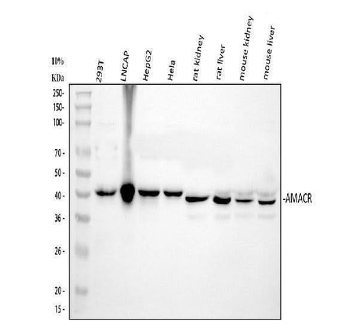 Anti-AMACR Antibody Picoband® Boster Bio