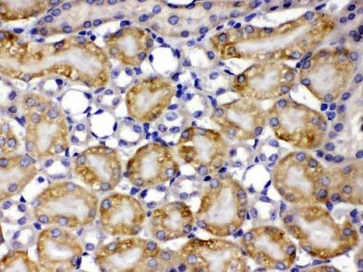 Anti-TCP1 theta/CCT8 Antibody Picoband® Boster Bio