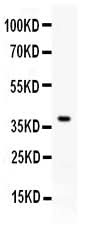 Anti-PD-L1/CD274 Antibody Picoband® Boster Bio