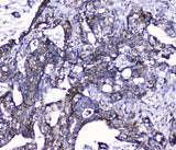 Anti-Cdk6 Antibody Picoband® Boster Bio
