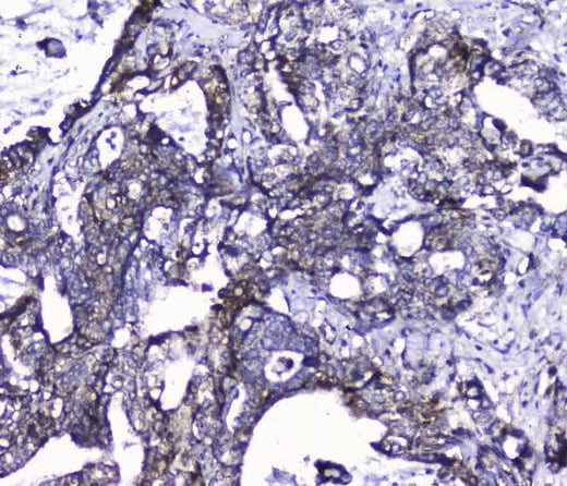 Anti-Cdk6 Antibody Picoband® Boster Bio