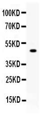 Anti-Carboxypeptidase B2/CPB2 Antibody Picoband® Boster Bio
