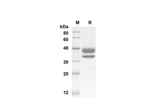 SDS-PAGE analysis of Mouse CCL1 proteins, 2 μg/lane of Recombinant Mouse CCL1 proteins was resolved with SDS-PAGE under reducing conditions, showing bands at 32.5 kDa.
