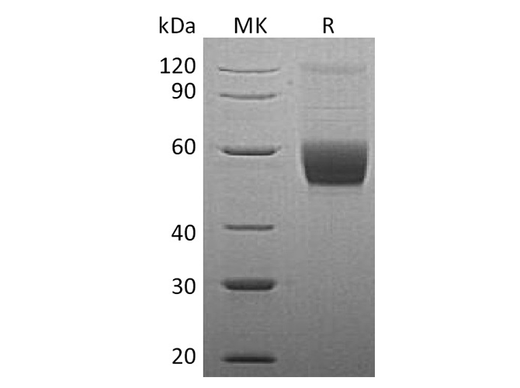 Recombinant Human Vaspin/SerpinA12 Protein (His Tag) - ABMIUM