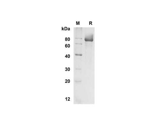 SDS-PAGE analysis of Human Fetuin B proteins , 2 μg/lane of Recombinant Human Fetuin B proteins was resolved with SDS-PAGE under reducing conditions , showing bands at 75-80 kDa.