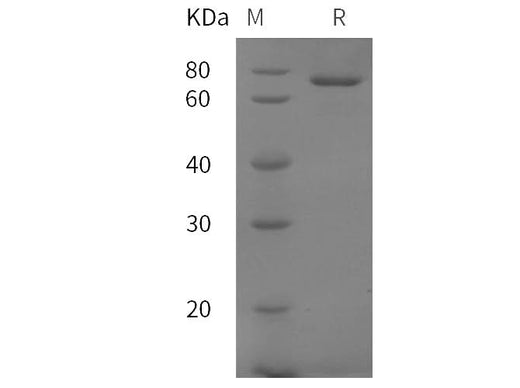SDS-PAGE analysis of Mouse Transferrin/TF proteins, 2 μg/lane of Recombinant Mouse Transferrin/TF proteins was resolved with SDS-PAGE under reducing conditions, showing bands at 70 kDa.