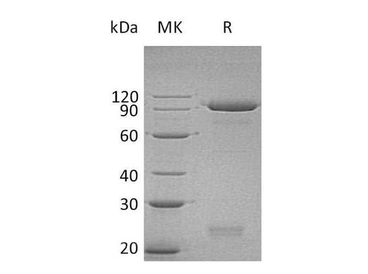 Recombinant Human Semaphorin 3C/SEMA3C Protein (His Tag) - ABMIUM