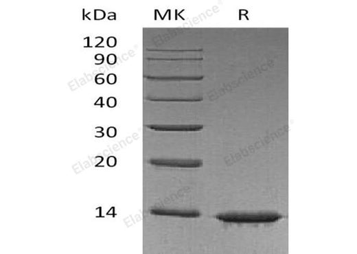 Recombinant Human Leptin Protein - ABMIUM