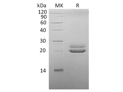 Recombinant Cynomolgus FGF-21/Fibroblast Growth Factor 21 Protein (His Tag) - ABMIUM