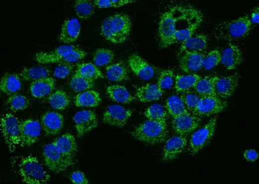 Anti-Human HIGD1A Antibody - ABMIUM