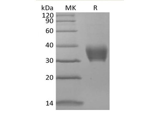 Recombinant Mouse BTNL4 (C-6His) - ABMIUM