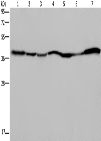 Anti-Human/Mouse/Rat GOT2 Antibody - ABMIUM