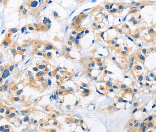 Anti-Human/Mouse/Rat HK1 Antibody