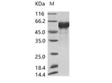 Recombinant AcmNPV Envelope glycoprotein gp64(His Tag) - ABMIUM