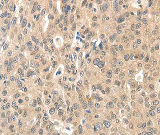 Anti-Human ROS1 Antibody