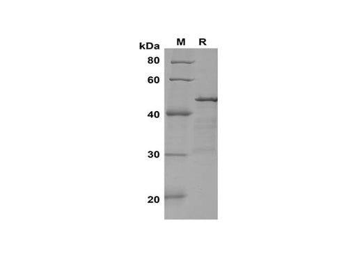 SDS-PAGE analysis of Rat IL-21 proteins, 2 μg/lane of ReCombinant Rat IL-21 proteins was resolved with SDS-PAGE under reducing conditions, showing bands at 45 kDa.