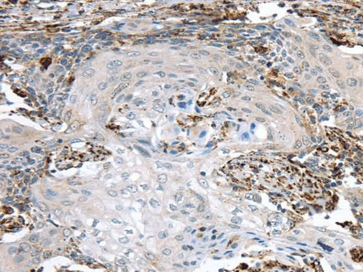 Anti-Human TBXA2R Antibody - ABMIUM