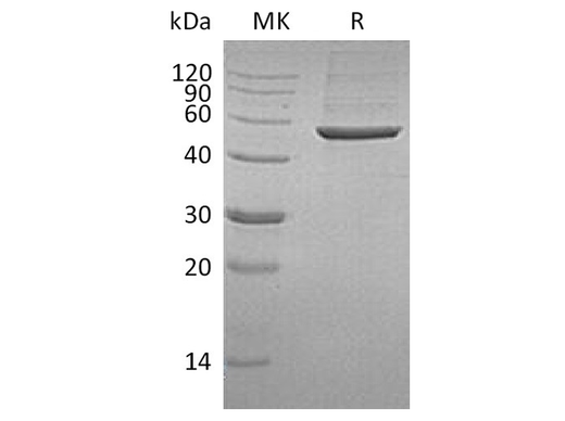 Recombinant Human PGD Protein (Human Cells, His Tag) - ABMIUM