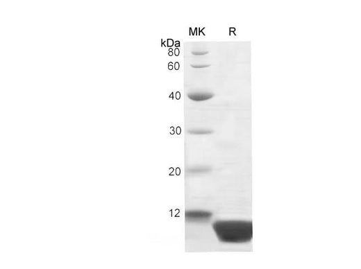SDS-PAGE analysis of Human proteins, 2 μg/lane of Recombinant Human proteins was resolved with SDS-PAGE under reducing conditions, showing bands at 10-11 kDa.