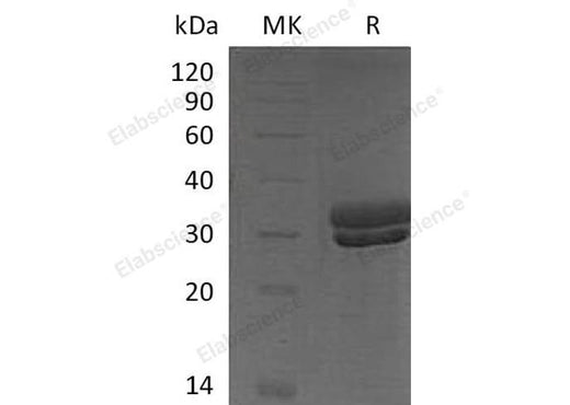 Recombinant Mouse Kallikrein 7/KLK7 Protein (His Tag) - ABMIUM