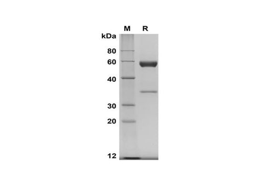 SDS-PAGE analysis of Human ANGPTL4 proteins, 2 μg/lane of Recombinant Human ANGPTL4 proteins was resolved with SDS-PAGE under reducing conditions, showing bands at 58 kDa.
