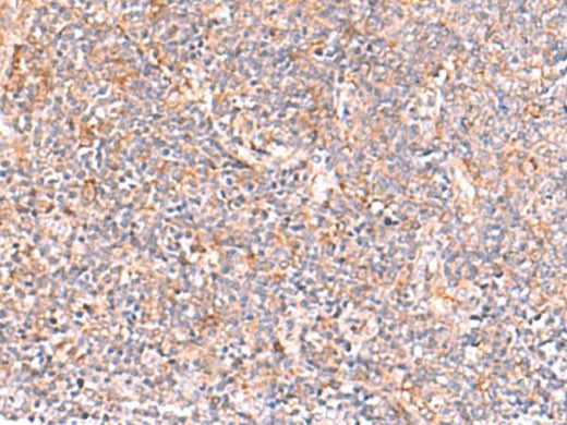 Immunohistochemistry of paraffin-embedded Human tonsil tissue using NADK Polyclonal Antibody at dilution of 1:95(×200)