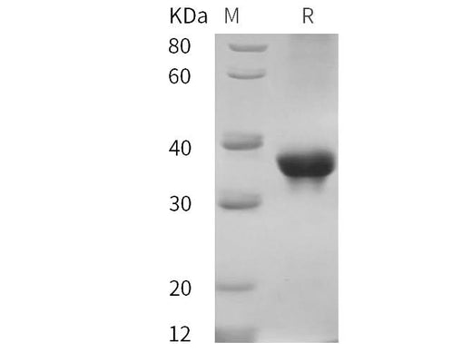 SDS-PAGE analysis of Cynomolgus macaques ABL1 proteins, 2 μg/lane of Recombinant Cynomolgus macaques ABL1 proteins was resolved with SDS-PAGE under reducing conditions, showing bands at 35 kDa.