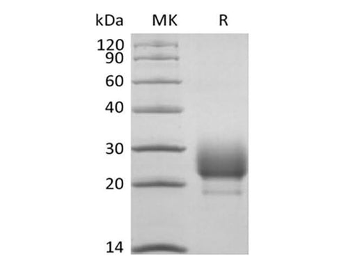 Recombinant Rhesus Macaque CD79B/B29 (C-6His) - ABMIUM