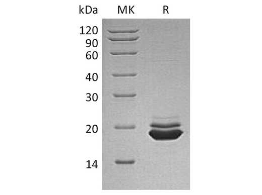 Recombinant Human APLP-1 Protein (aa 42-212, His Tag) - ABMIUM