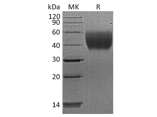 Recombinant Human IL10-RA/IL-10 Rα Protein (His Tag) - ABMIUM