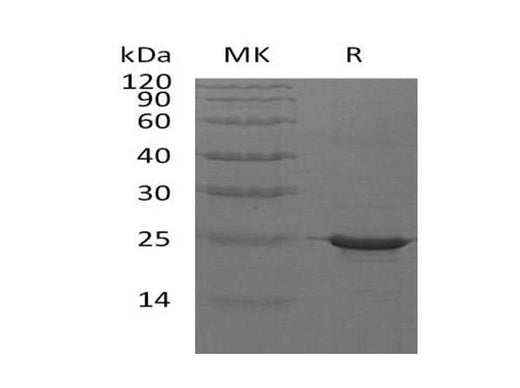 Recombinant Human CRYAB Protein (His Tag) - ABMIUM