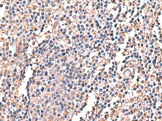 Immunohistochemistry of paraffin-embedded Human tonsil tissue using LDHAL6B Polyclonal Antibody at dilution of 1:60(×200)