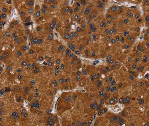 Anti-Human/Mouse/Rat NPHS2 Antibody