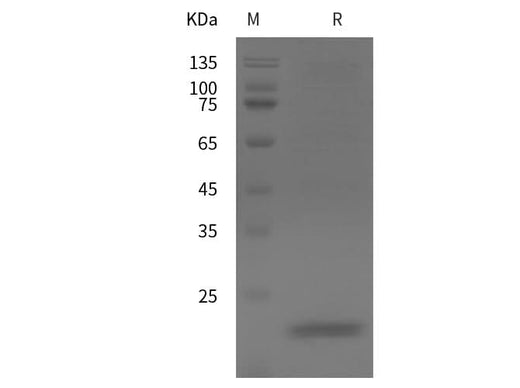 SDS-PAGE analysis of Mouse IL10 proteins, 2 μg/lane of Recombinant Mouse IL10 proteins was resolved with SDS-PAGE under reducing conditions, showing bands at 22 kDa.