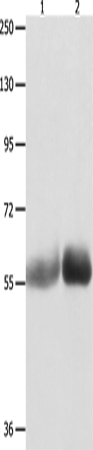 Anti-Human MUTYH Antibody - ABMIUM