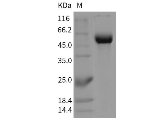 Recombinant Mouse Siglec-2/CD22 Protein (Fc Tag) - ABMIUM