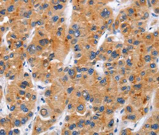Anti-Human CD137 Antibody