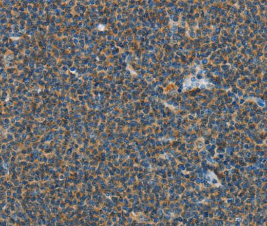Anti-Human/Mouse PITX3 Antibody - ABMIUM