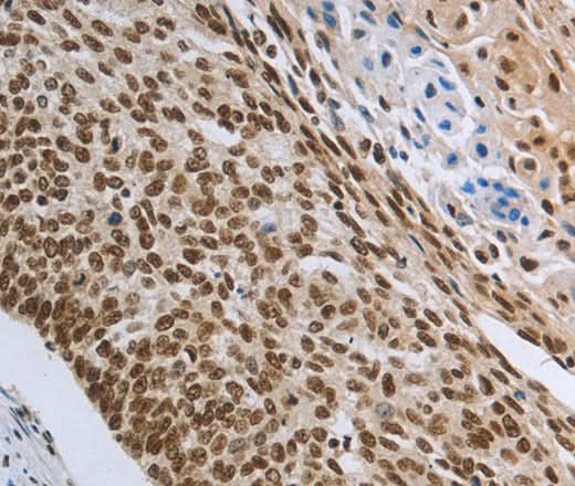 Anti-Human PRMT3 Antibody - ABMIUM