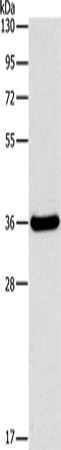 Anti-Human/Mouse/Rat FGL1 Antibody - ABMIUM