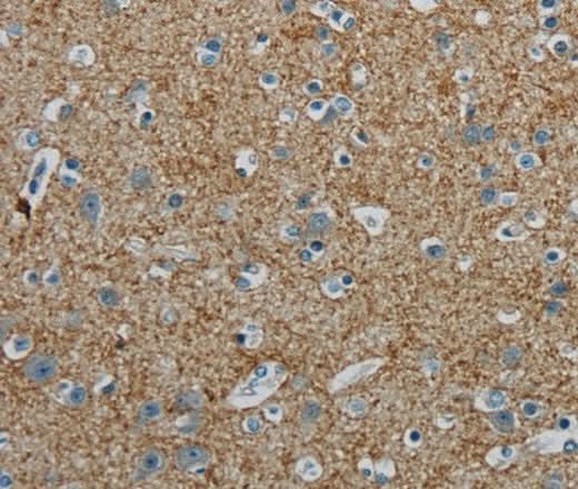 Anti-Human/Mouse/Rat PGLYRP1 Antibody - ABMIUM