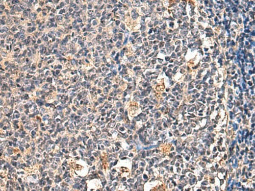 Immunohistochemistry of paraffin-embedded Human tonsil tissue using ENTPD1 Polyclonal Antibody at dilution of 1:60(×200)