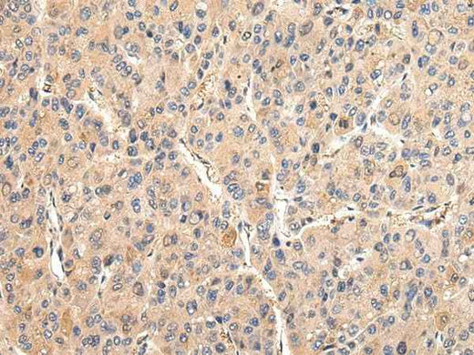 Anti-Human/Mouse/Rat VCAM1 Antibody