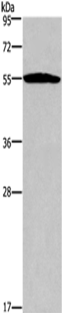 Anti-Human SERPINA1 Antibody - ABMIUM