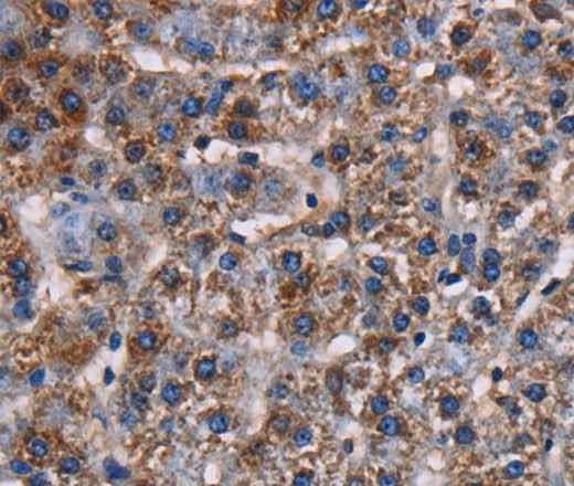 Anti-Human/Mouse/Rat KCNK1 Antibody