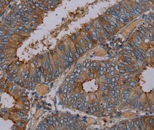 Anti-Human/Mouse/Rat PYY Antibody