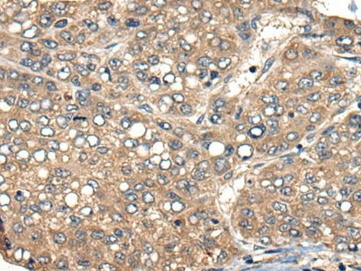 Anti-Human ACER1 Antibody - ABMIUM
